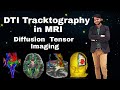 How Can DTI Post processing 3D imaging in MRI or DTI Tracktography - Naresh Gehlot