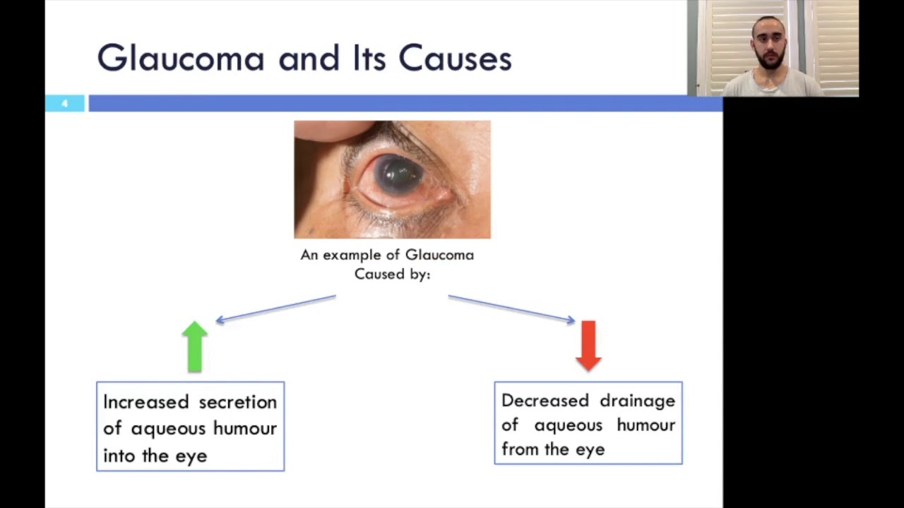 Rhoassociated protein kinase inhibitors, a novel way to treat