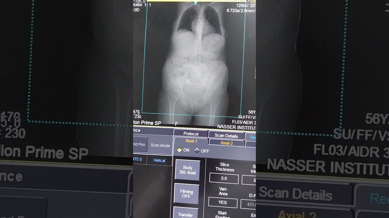 الجزء الثاني سوفت وير كانون (توشيبا)