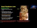 Dr jeimylo de castro talks about msk ultrasound of the anklefootpart 1