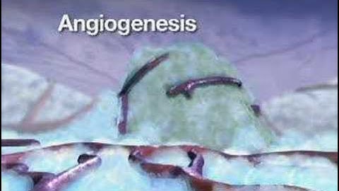 Angiogenesis