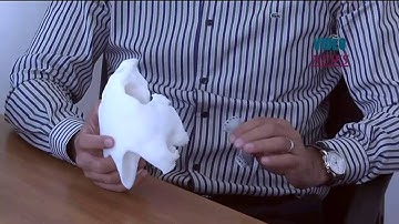 3D prothesis chin designed for caretta caretta in Turkey