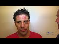 John Molina wins by TKO over Mickey Bey.