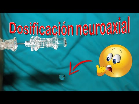 Vídeo: Un Enfoque Novedoso Para La Anestesia Neuroaxial: Aplicación De Una Identificación De Hito Espinal Automatizada Por Ultrasonido