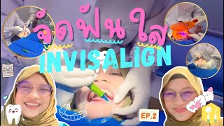 จัดฟันใสInvisalign,ติดปุ่มAttachment,ถ่ายภาพฟัน,ทำความสะอาดฟัน EP.2 | Fedia Firdow