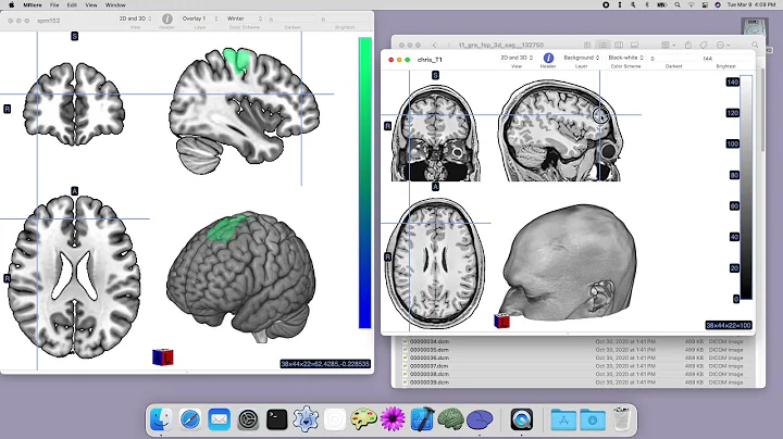 MRIcro a simple open source viewer of CT and MRI scans for macOS