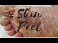 DIY Skin Peel | Healing Cracked Heels !!