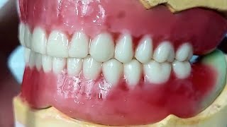 شرح Setting (Arrangement) of artificial teeth #prosthesis