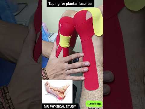 Taping for plantar