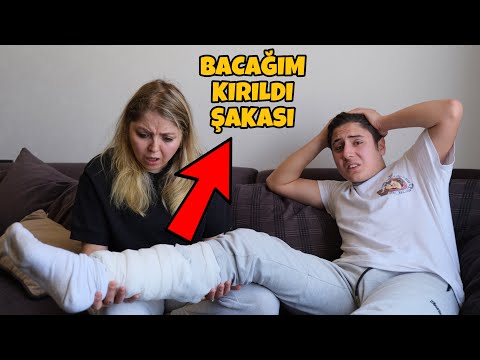 ANNEME BACAĞIM KIRILDI ŞAKASI !! (ÇOK KORKTU)