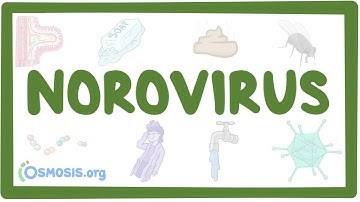 Norovirus- causes, symptoms, diagnosis, treatment, pathology