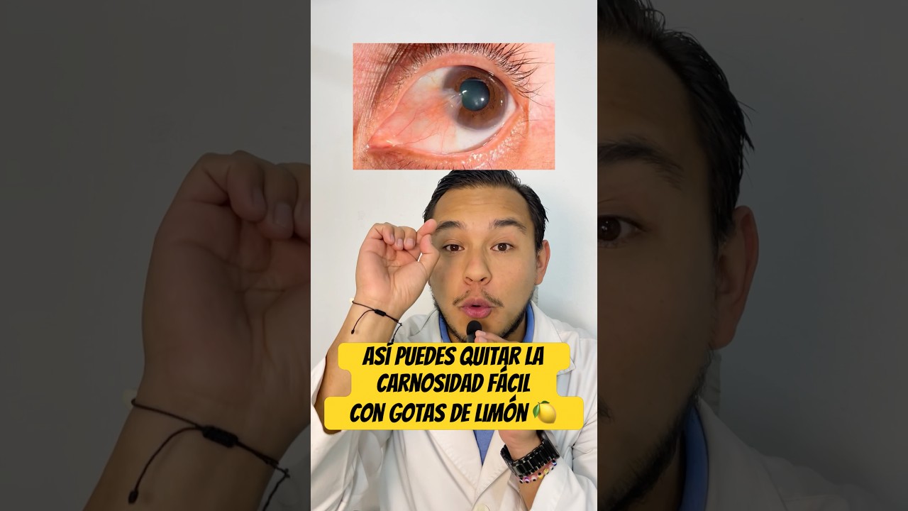 Como quitar la carnosidad con limón? 🕊️ 