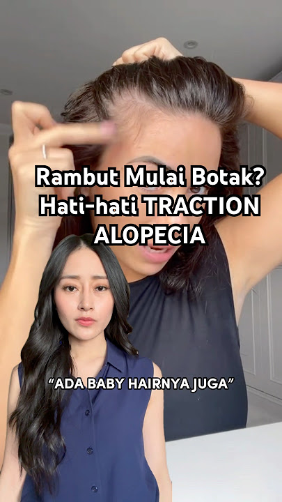 Pinggir Rambut mulai Botak? Cek gih, hati-hati Traction Alopecia | dr. Clarin Hayes,MBiomed(AAM)