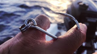This Is Going To Hurt... How To Remove A Massive Fishing Hook.