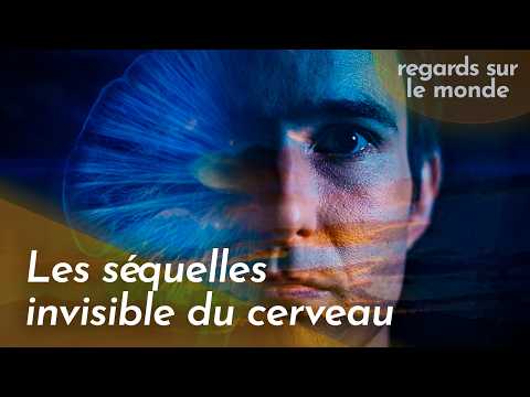 Traumatisme crânien : les séquelles invisibles qui bouleversent une vie