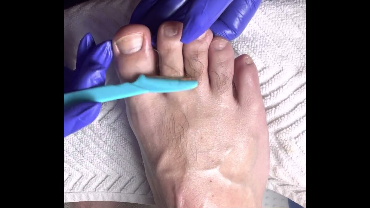 Manscaping Hairy Feet (Must Watch) (Left Foot)