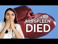 DOCTOR STORY TIME: His Spleen DIED After A DENTIST Appointment