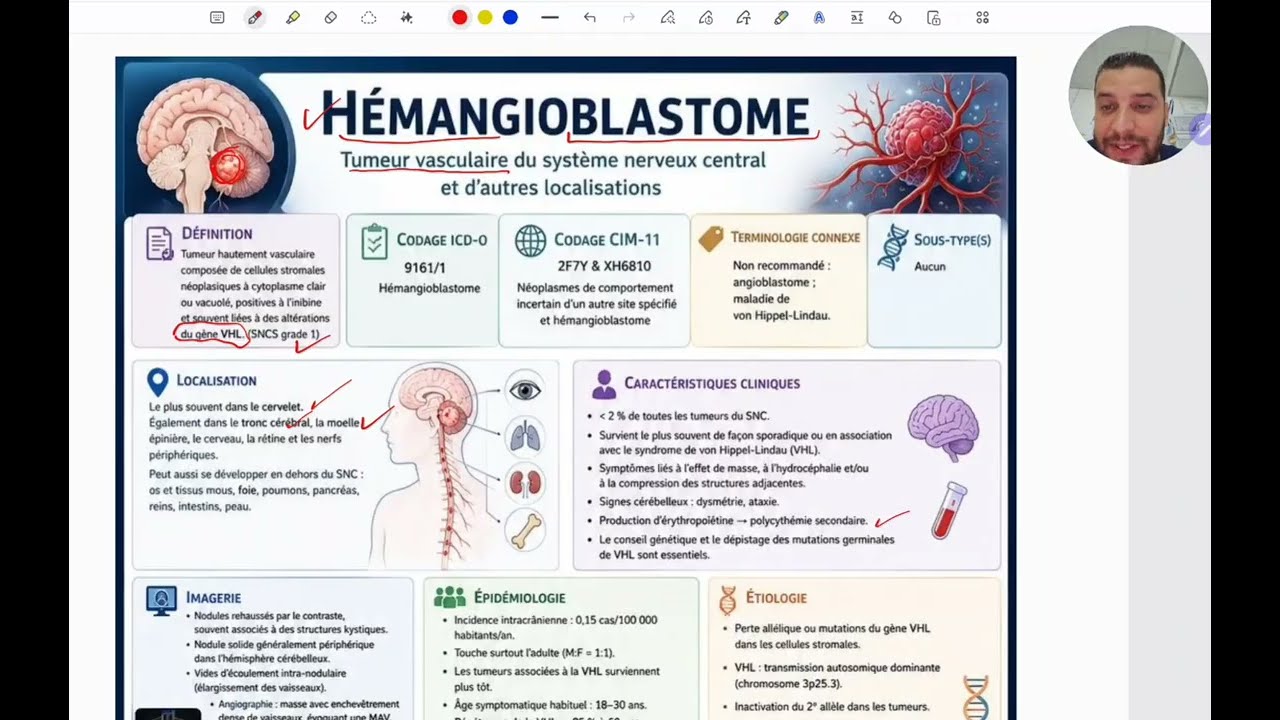 Hémangioblastome