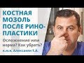 Костная мозоль после ринопластики: осложнение или норма?