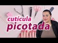 Cutículas picotadas, o que fazer?