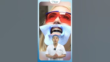 Lấy Cao Răng Có Bị Mòn Men Răng Không? | Nha Khoa Minh Châu