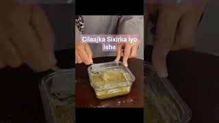 Cilaajka Sixirka Iyo Isha