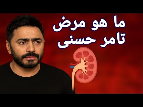 ما هو مرض تامر حسنى و هل له علاقة بالأورام