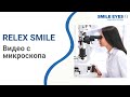 Операция ReLEx SMILE (СМАЙЛ) лазерной коррекции зрения - видео с микроскопа