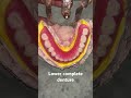 Lower complete denture 😬😬😬#apexdental #splittooth #dentistry #partialdenture #orthodontist