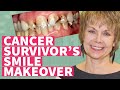 Cancer Survivor’s Smile Transformation - Cancer Damaged Teeth - Cosmetic Veneers