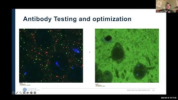 2023BioEMTalks 3 Jenna Schardt