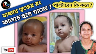 How To Make Baby Skin Fair at Home in Bengali || Baby Skin Care || bacha ke forsa korar upay screenshot 5