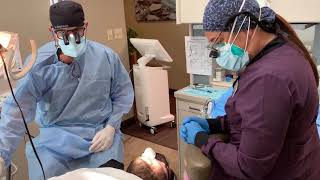 Apicoectomy Surgery by Thomas O Marxen DDS, MSD Advanced Care Dentistry Woodinville 