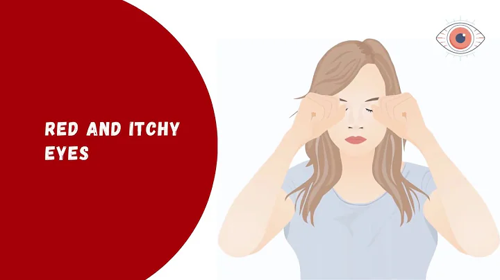 What are the Symptoms of Dry Eye | Eye Care Clinics Near Me | Nelivigi Eye Hospital