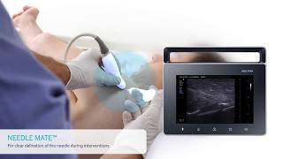 Samsung Medison UGEO PT60A