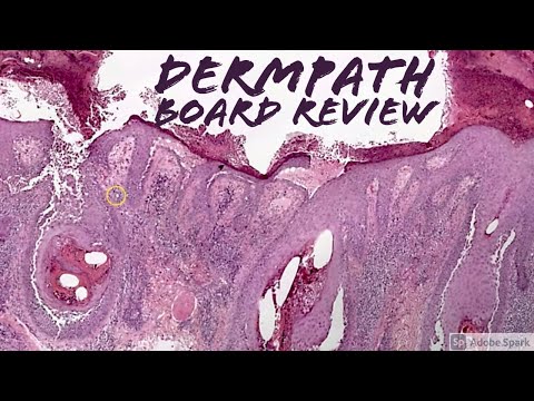 Dermpath Board Review: Pemphigus, Tattoo, Tick, Mycosis Fungoides, Keloid, Langerhans Histiocytosis