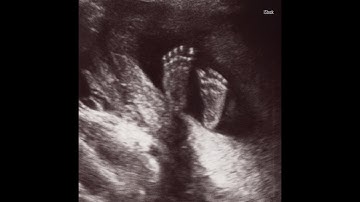 The Daily Signal: Oregon Lawmakers Vote to Bail Out Planned Parenthood | The Daily Signal