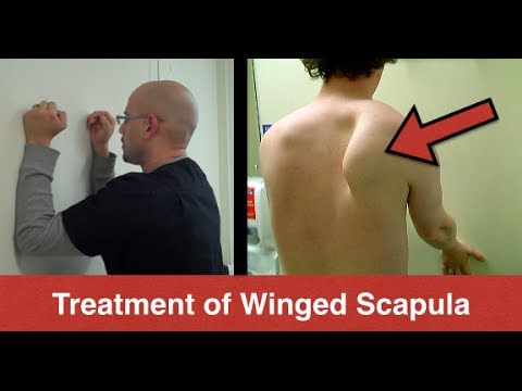 BEST Winged Scapula Exercises (Fix Scapular Winging Treatment ...