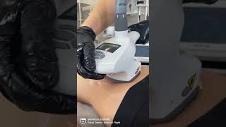 Zemits presents the Bionexis Lite vacuum roller massage and ultrasonic cavitation device