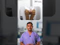 Colorectal Cancer Symptoms That Are NOT Piles 🚨