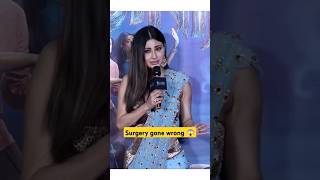 Mouni Roy's face Surgery gone wrong 😱😱😱 her forehead bumps || what's happened on her face??