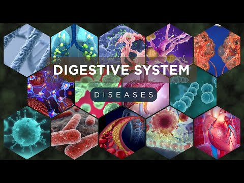 Digestive Diseases Explained