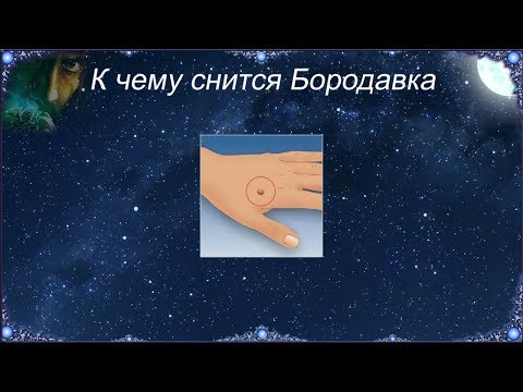 К чему снится Бородавка (Сонник)