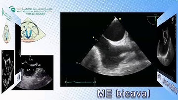 Normal Views Full TEE KAMC