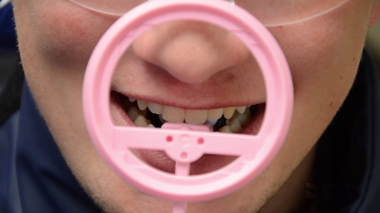 RINN FlipRay Phosphor Plate Holder Dentsply Sirona YouTube