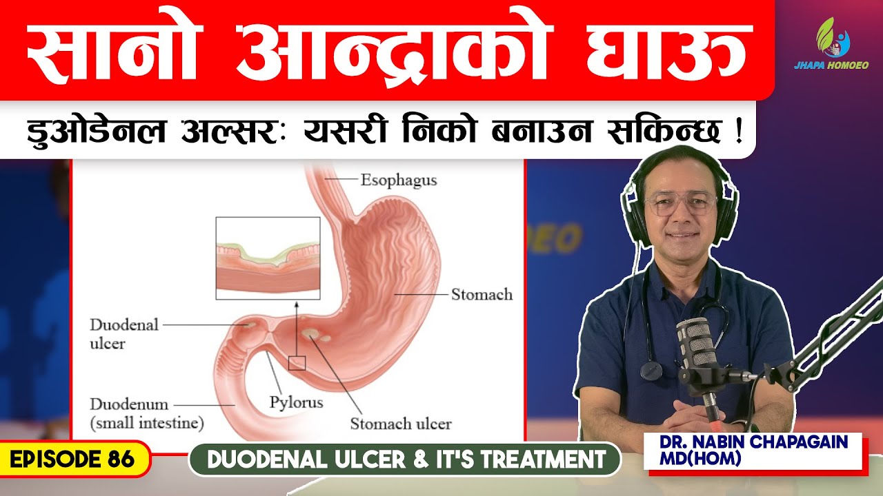 सानो आन्द्राको घाऊ ( Duodenal Ulcer ) निको बनाउने सजिला उपायहरु | Episode - 86 | Dr. Nabin Chapagain