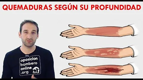 ¿Qué grado de quemadura es el más profundo?