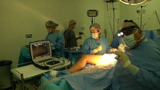 chirurgie cu laser varicoză picior