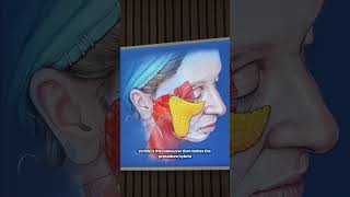 Hybrid Facelift Explained
