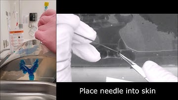 PCNL- Bullseye technique instructional video